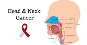 Head &amp; Neck Cancer Awareness: Understanding the Signs, Reducing the Risks, and Supporting Our Community